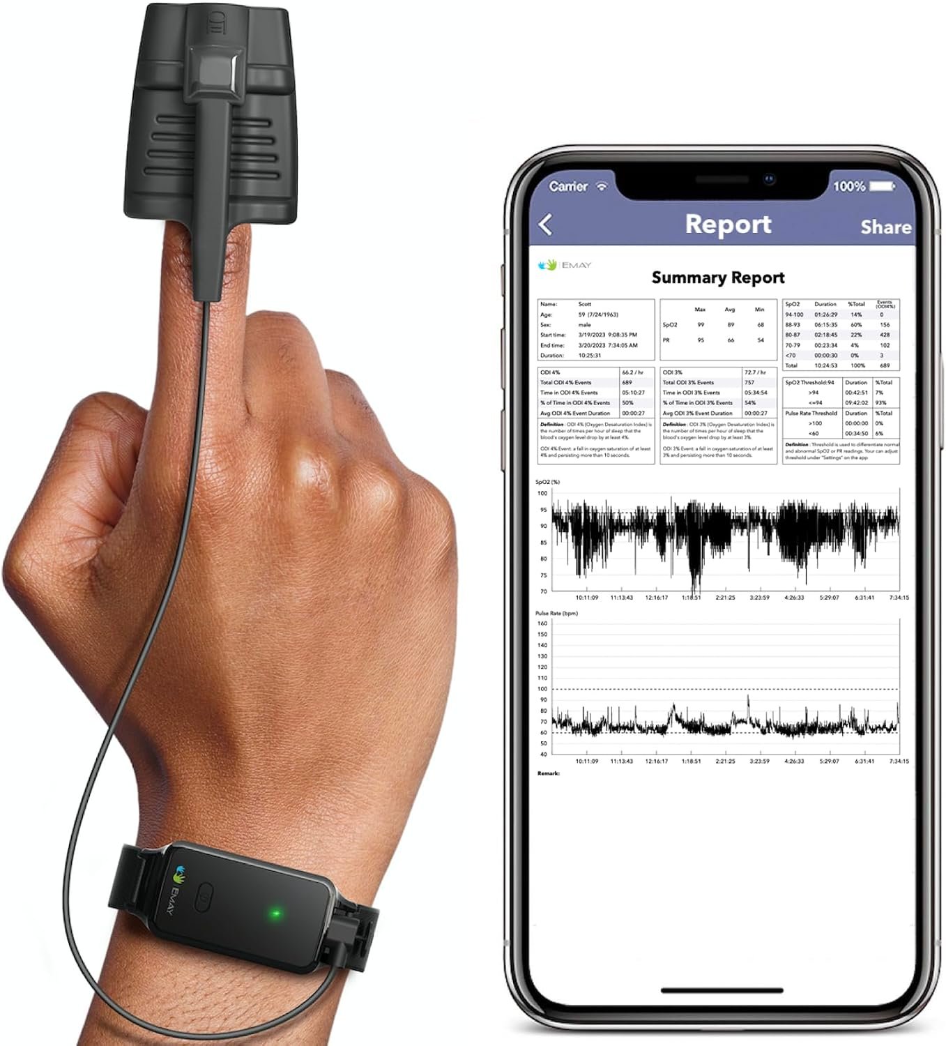 EMAY SleepO2 Wrist Pulse Oximeter with Recording Capability | Sleep Pulse Oximeter for Blood Oxygen Saturation Tracking Continuously | Provides Sleep Report and Raw Data